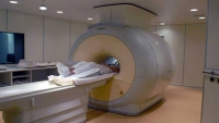 نحوه MRI گرفتن از مغز